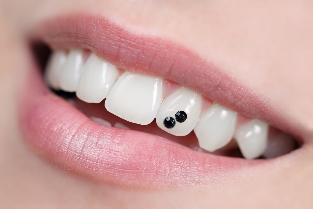 bijuterii dentare