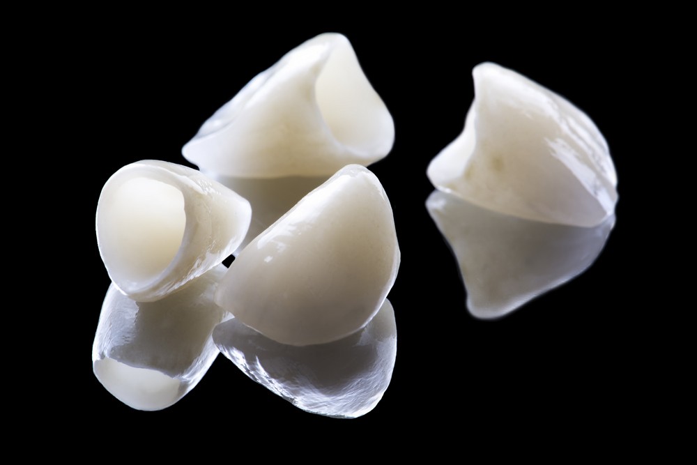 coroane dentare Emax